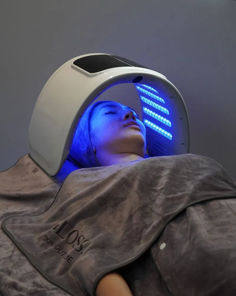 Blue Light LED Thrapy for Acne Skin Singaporean Woman