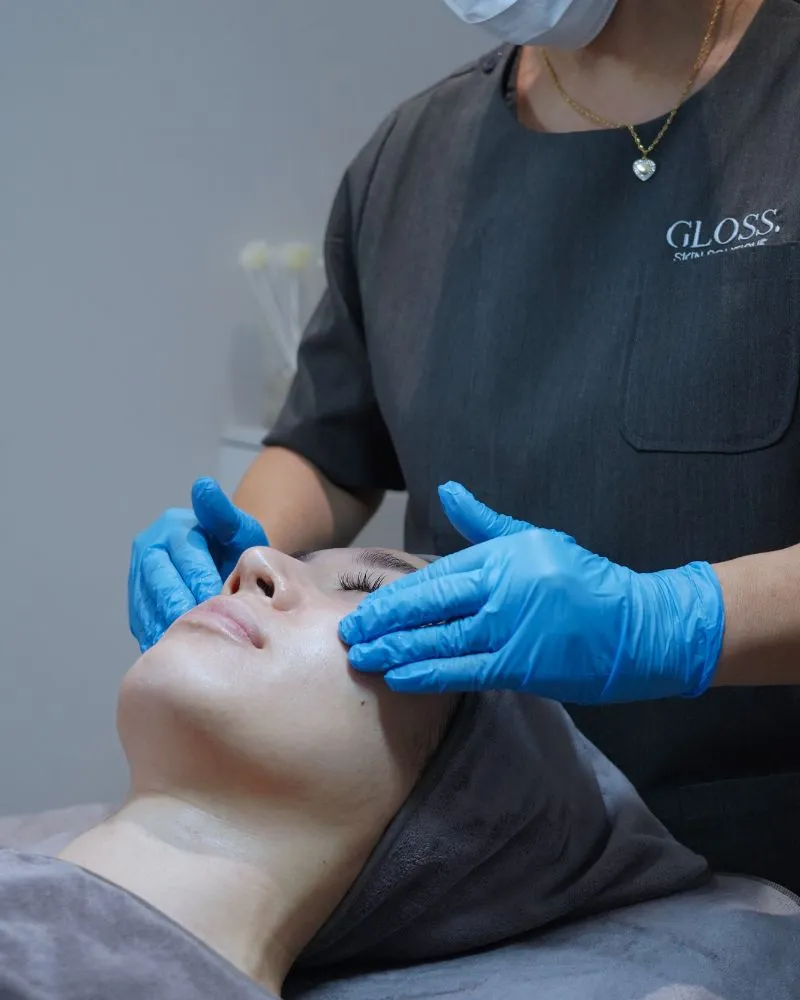Chemical Peel Treatment for Wrinkles and Fine Lines Skin Singapore Female
