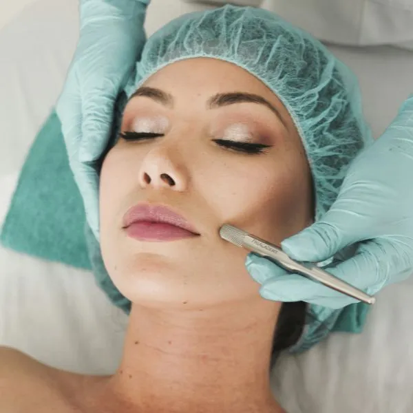 Enzyme Peel Hero Image