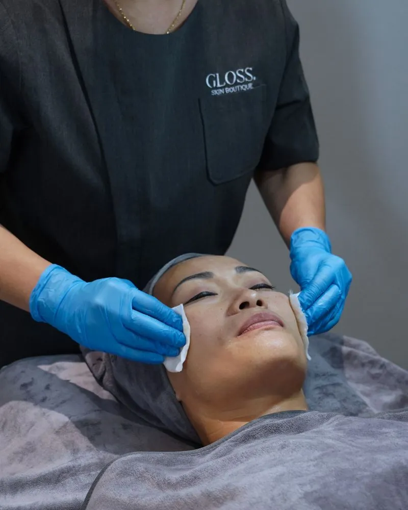 Enzyme Peel Treatment in Action
