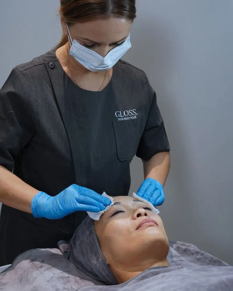 Enzyme Peel Treatment for Dull Skin Singapore Female