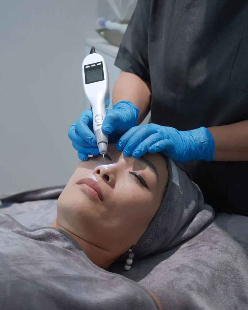 Gloss Hot Plasma Treatment for Acne Scars and Acne Skin
