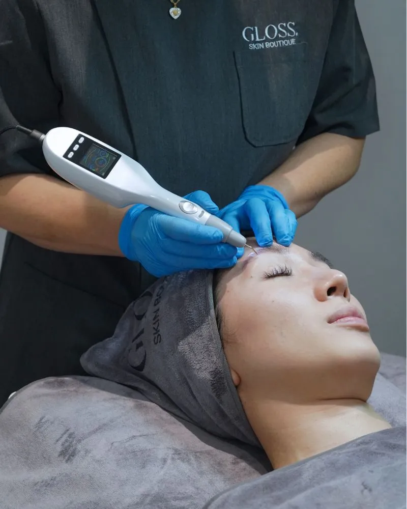 Gloss Hot Plasma Treatment for Pigmentation and Dark Spots Skin