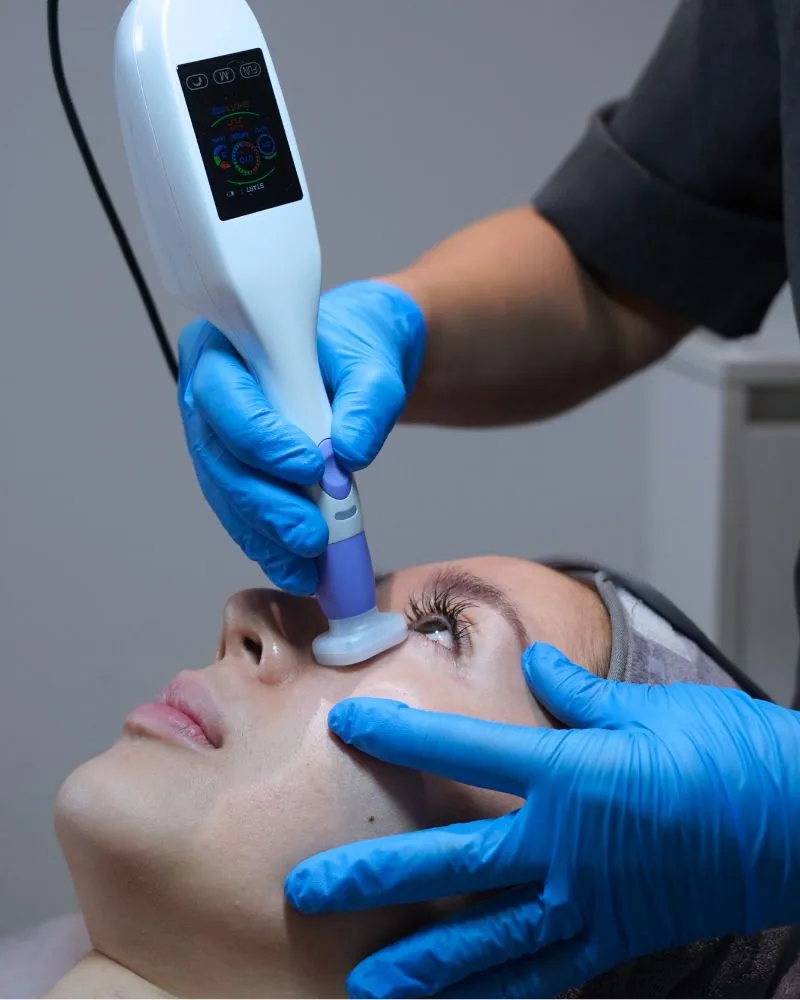 Gloss Plasma Treatment for Acne Scars and Acne Skin
