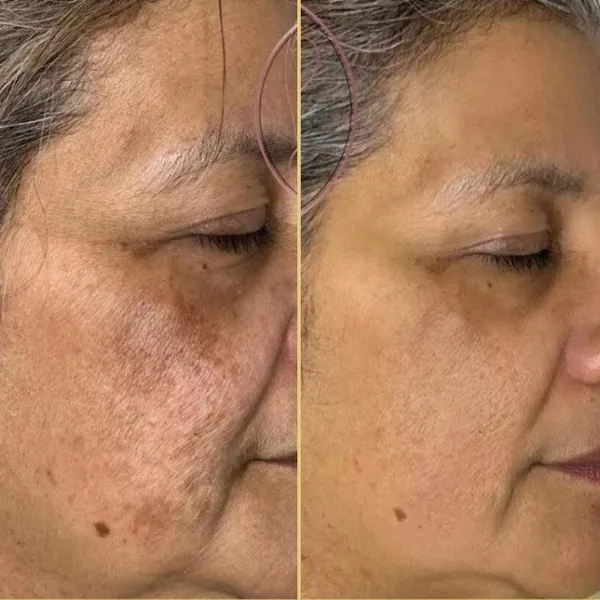 Transformation 1
